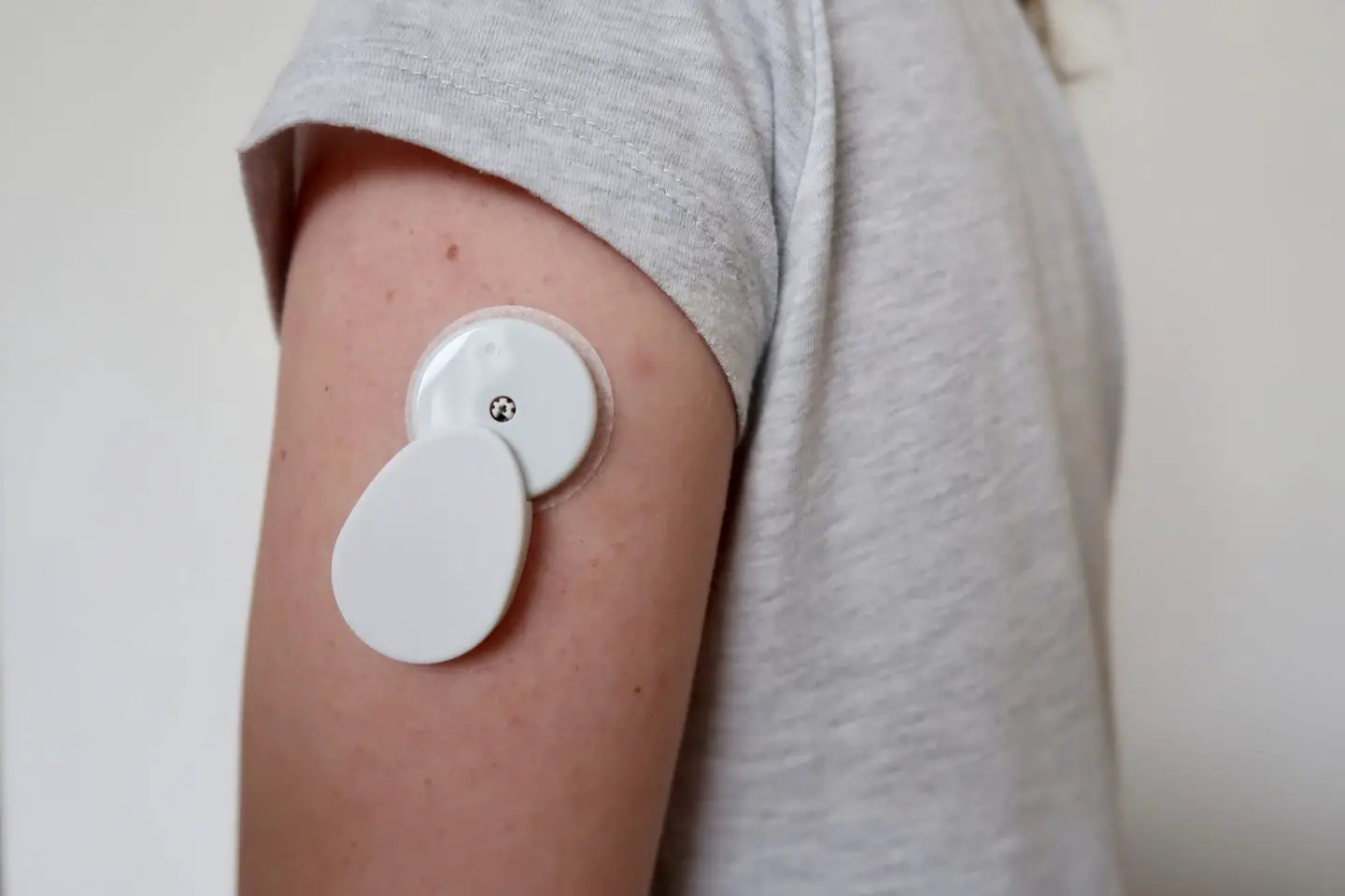 A close up of a round Freestyle Libre and Bubble CGM on a woman's arm