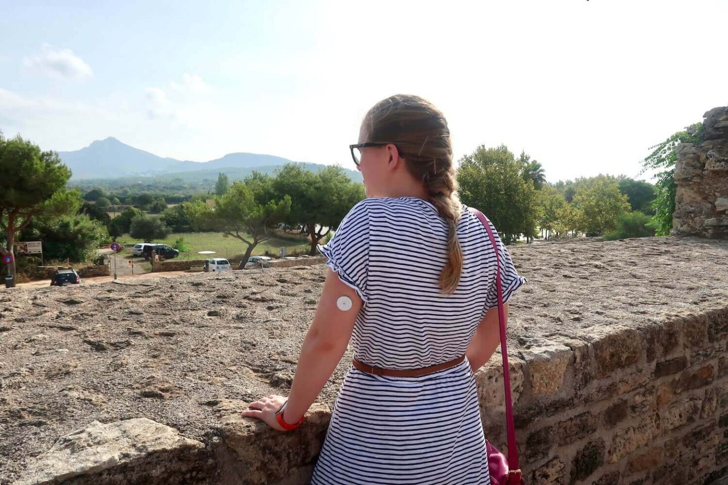 A woman standing at a wall in Alcudia, Majorca, and looking out over the view. She is wearing a striped dress and a freestyle libre sensor